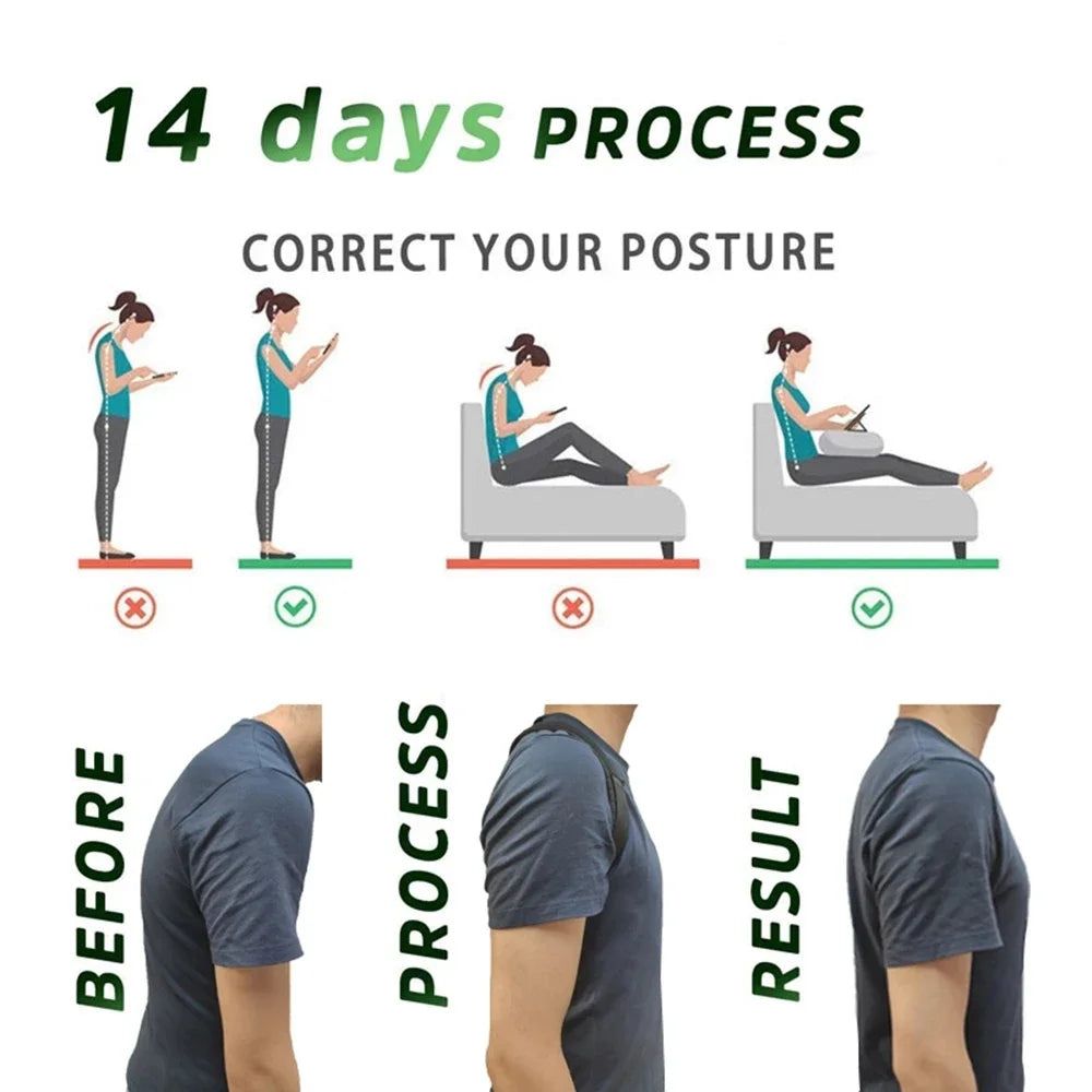 Back Posture Correction Belt – Male/Female Hunchback & Slouch Support (S/M/L/XL)